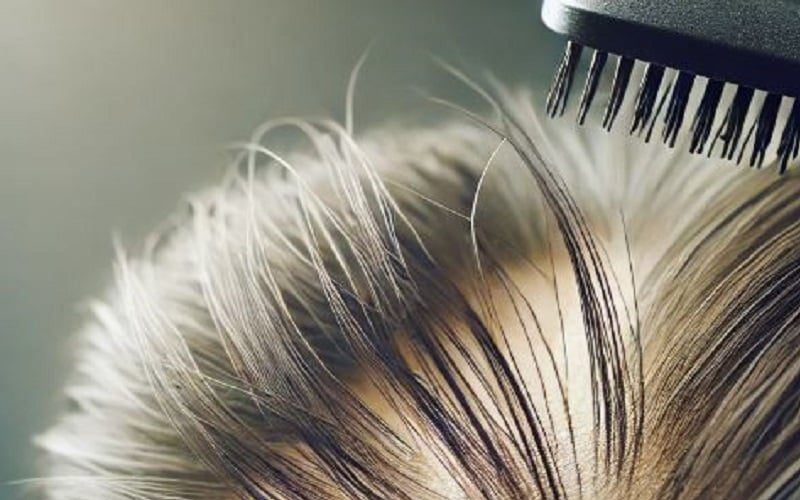 Vì sao căng thẳng lại gây rụng tóc? Giải mã từ A-Z