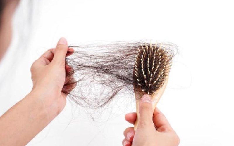 Nguyên nhân gây rụng tóc, hói đầu sớm ở người trẻ